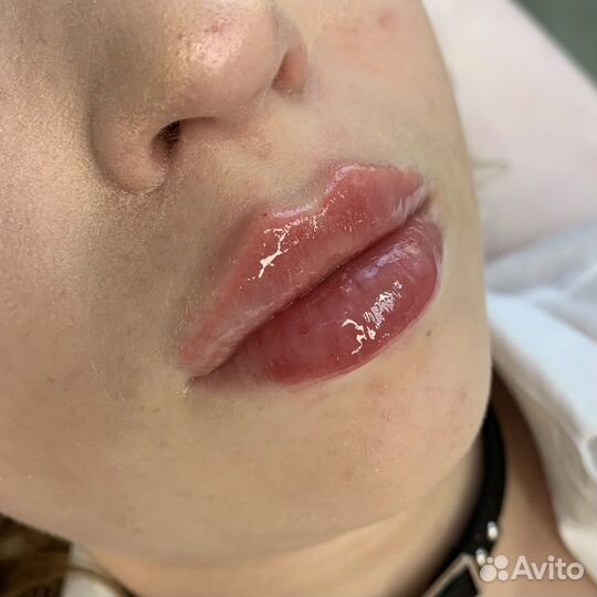 Врач косметолог