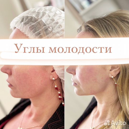Услуги косметолога