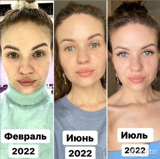 Маска для лица