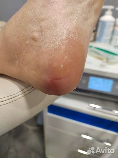 Подолог. Медицинский педикюр