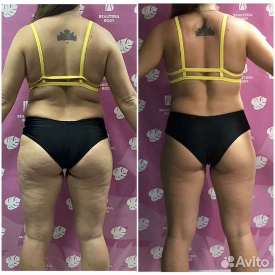 Абонемент в фитнес клуб