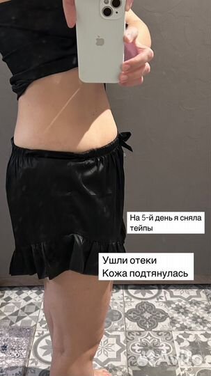 Тейпирование лимфодренажное