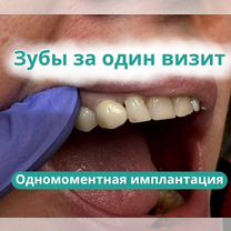 Одномоментная имплантация зубов, Омск