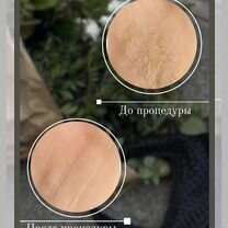 Шугаринг/Ваксинг, Саратов