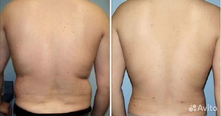 Массаж на дому