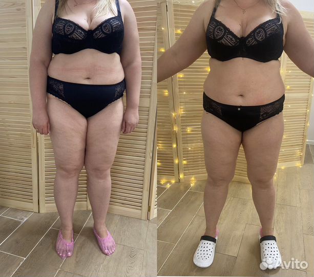 Lpg массаж тела и лица,жиротоп Microwave