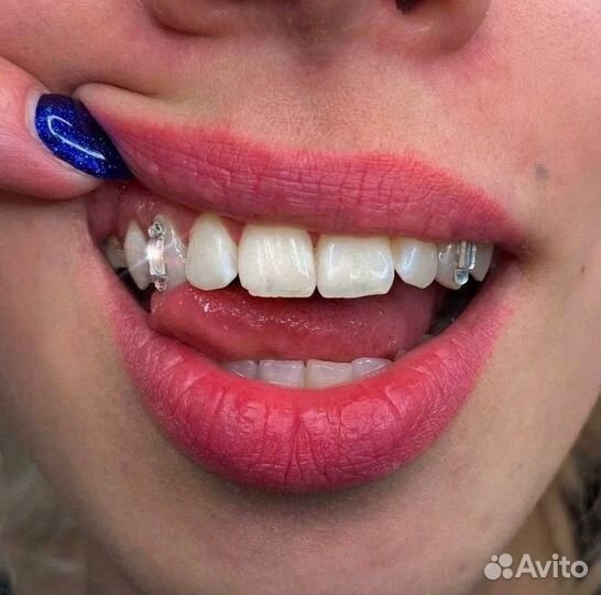 Установка скайсов