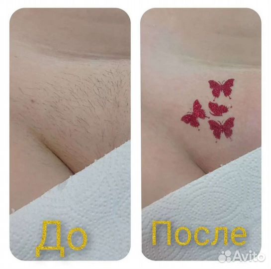 Шугаринг/Воск