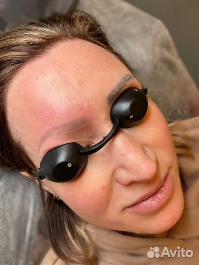 Лазерное удаление татуажа пикосекнудным лазером