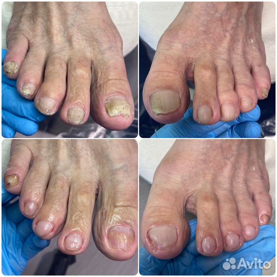 Услуги подолога