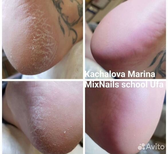 Маникюр,педикюр,полный педикюр