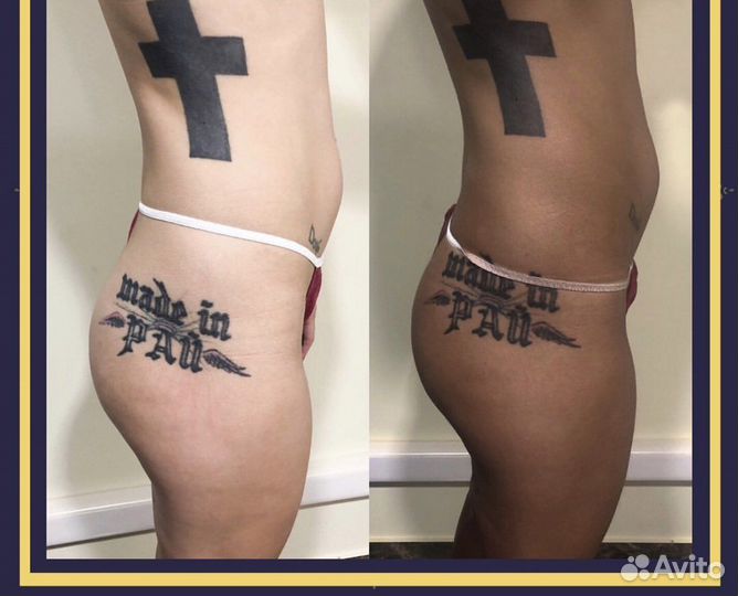 Моментальный загар