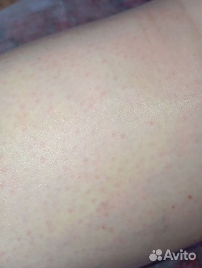 Шугаринг ваксинг