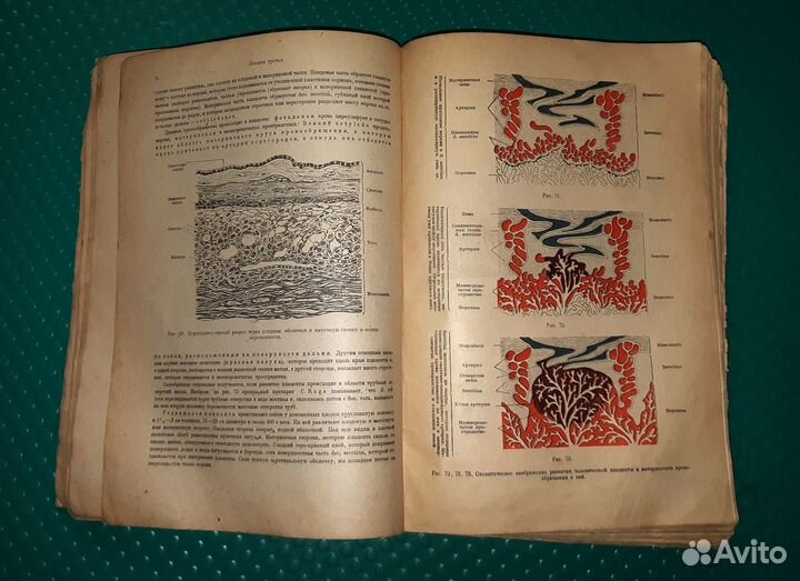 Антикварные книги, книги по медицине, Бумм Эрнст