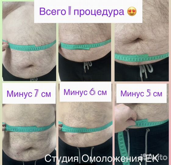 Liposonix Живот+ Бока
