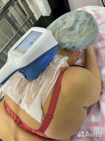 Криолиполиз процедура