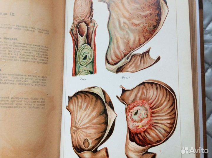 Антикварные книги по медицине