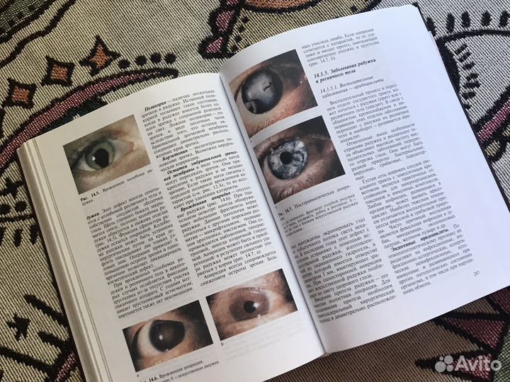 Глазные болезни Копаева