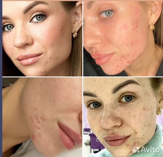 Маска для лица