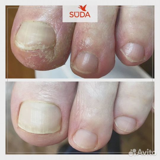 Крем Suda
