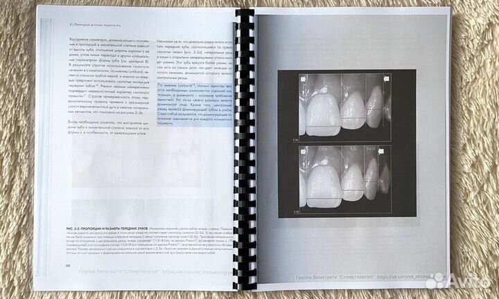 Адгезивные керамические реставрации