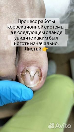 Мастер педикюра подолог