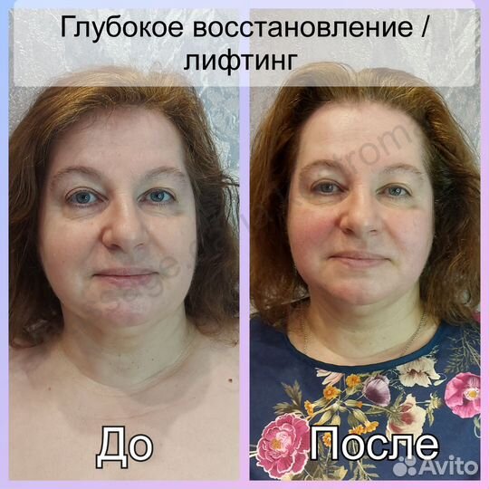 Массаж лица