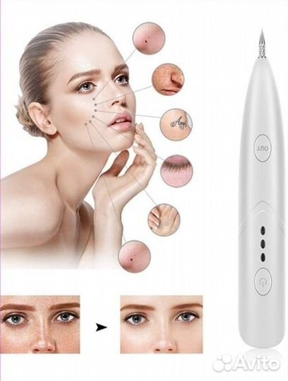 Лазерная машинка для удаления черных точек новая