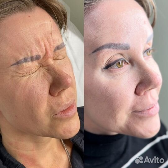 Модели губы