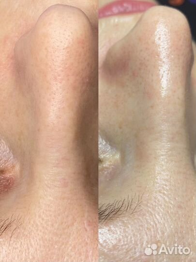 Услуги косметолога