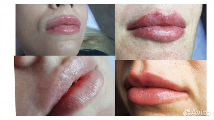 Услуги косметолога