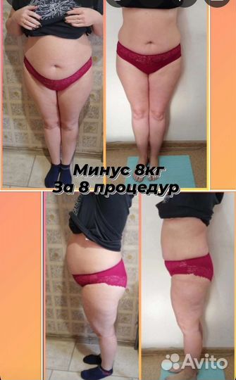 Антицеллюлитный массаж и коррекция фигуры