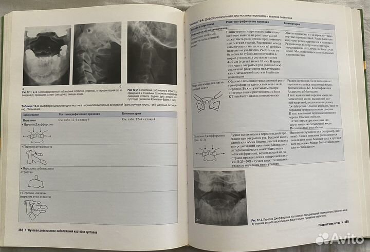 Лучевая диагностика заболеваний костей и суставов