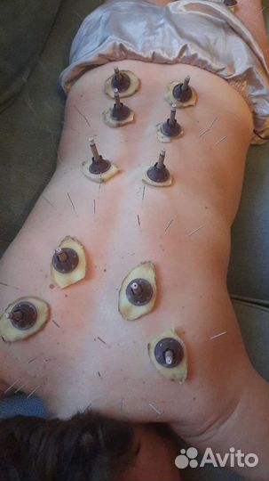 Тибетский массаж