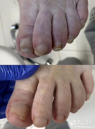 Педикюр подолог маникюр