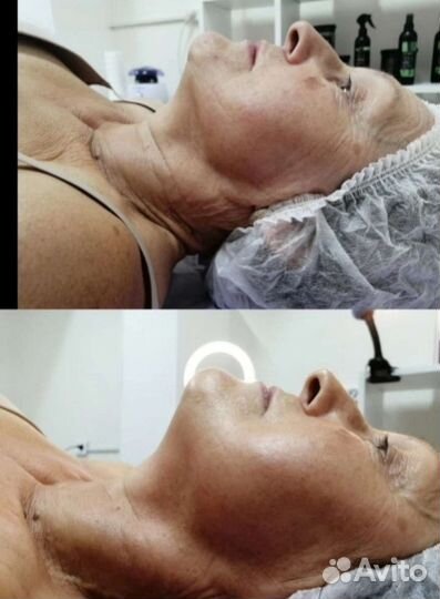 Шугаринг сахарное моделирование