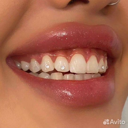 Установка скайсов