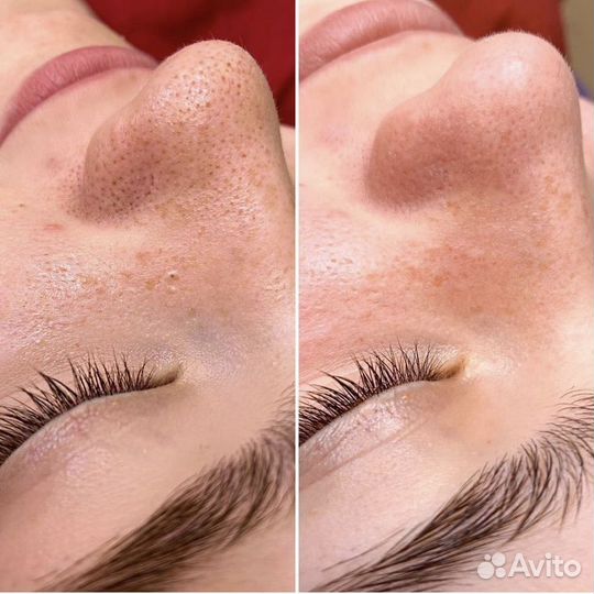 Услуги косметолога