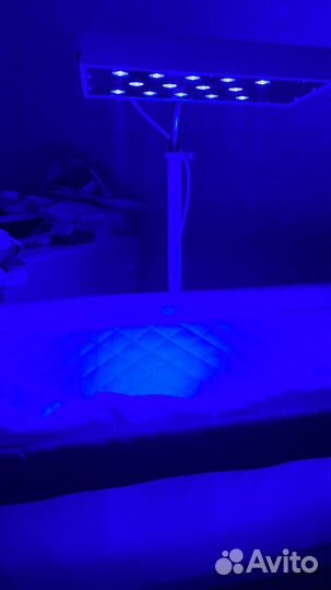 Фотолампа от желтушки