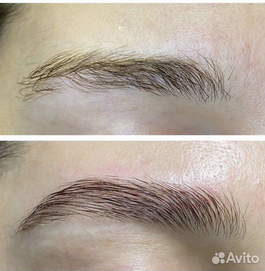 Бровист Броволог