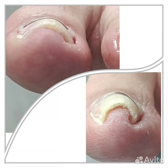 Педикюр Подолог Маникюр