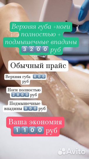 Лазерная эпиляция