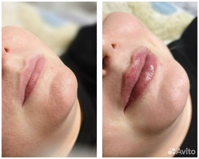 Услуги косметолога