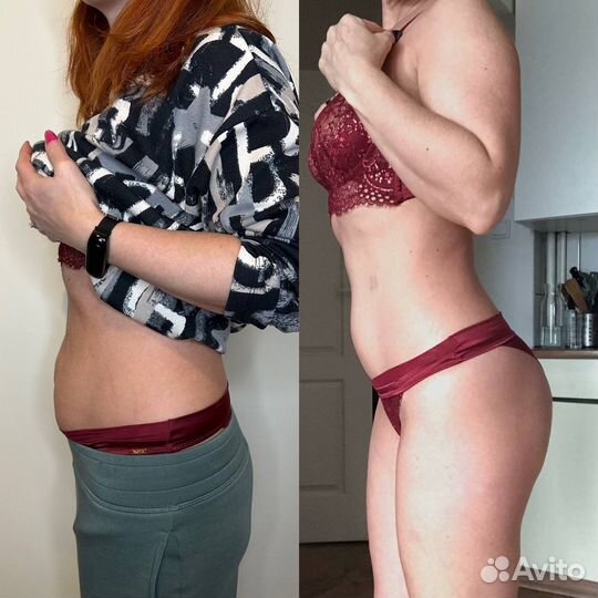 Похудение криолиполиз кавитация RF