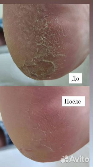 Подолог / мастер маникюра и педикюра