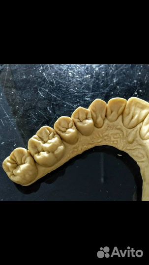 3D моделировка exocad, 3 shape