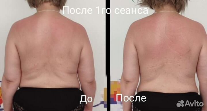 Оздоровительный массаж.Коррекция фигуры. Лицо