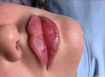 Обучение увеличение губ, мезотерапия, ботокс
