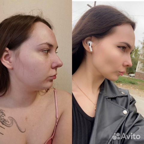 Консультация нутрициолога