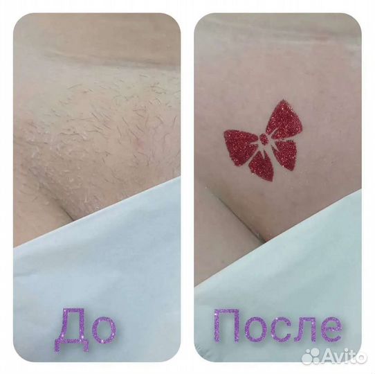 Шугаринг/Воск